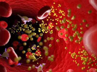 an image of blood within an atery